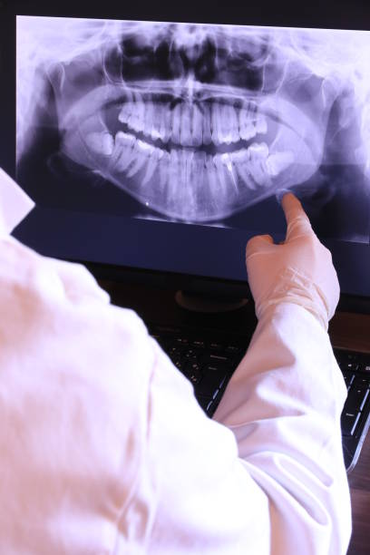 Best Emergency Treatment for Oral Infections in Crane, MO